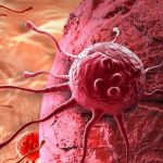 Ученые создали препарат, убивающий клетки рака молочной железы