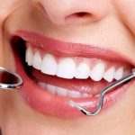 У переболевших COVID-19 могут выпасть зубы