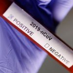 Первый случай коронавируса подтвержден в Молдове