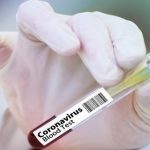 Словакия начала всеобщее тестирование населения на коронавирус