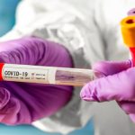 За последние сутки в Азербайджане тесты 2266 человек на коронавирус дали положительный результат