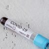 Израильские ученые заявили о взаимосвязи лишнего веса и антител от COVID-19