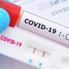 TƏBİB предупредил о возможном сезонном росте случаев заражения COVID-19