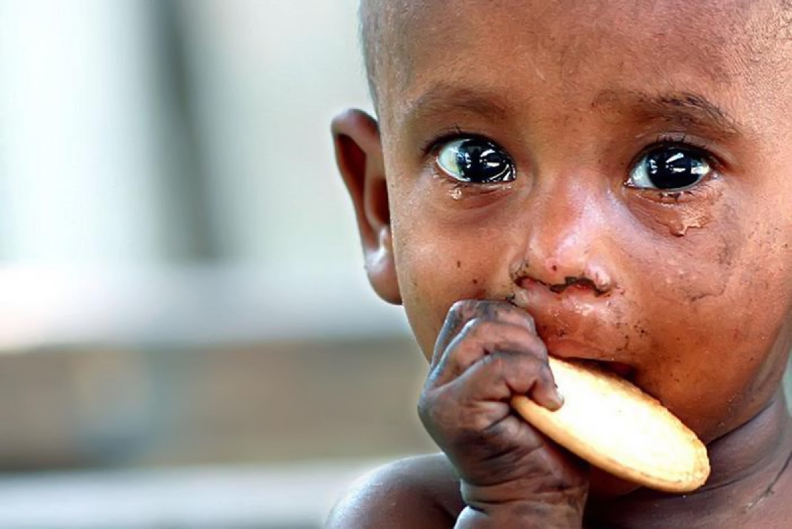 Причины недоедания
