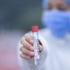В России выявили 22 144 новых случая коронавируса за сутки