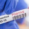 Число подтвержденных случаев заражения коронавирусом в мире достигло 600 млн
