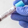 В Азербайджане за сутки выявлено 630 случаев заражения коронавирусом