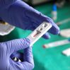 ВОЗ сообщила о снижении смертности от коронавируса в мире