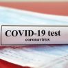 СМИ: В Европе растет число случаев инфицирования COVID-19, появляются более опасные варианты
