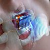 Корейцы создали ультразвуковую беспроводную зарядку для имплантов в теле