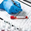 За сутки в Азербайджане зарегистрирован 71 случай заражения коронавирусом