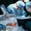Трансплантация печени, почек, костного мозга или гемопоэтических стволовых клеток включены в ОМС