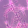 В Европе распространяется устойчивый к лечению «супергрибок» Trichophyton indotineae В Европе распространяется устойчивый к лечению «супергрибок» Trichophyton indotineae